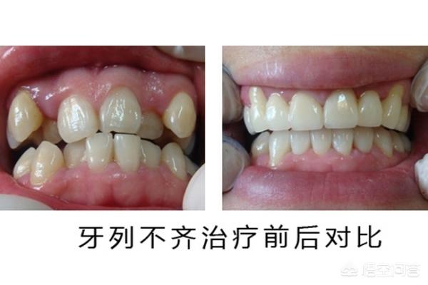 弥勒最新24小时牙医在线咨询方法分析(最方便真实的弥勒有没有24小时牙医方法)
