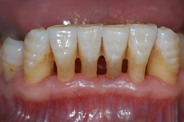 弥勒最新24小时牙医在线咨询方法分析(最方便真实的弥勒有没有24小时牙医方法)